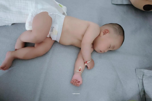 龙海宝宝头上长痱子